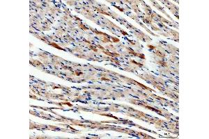 IHC analysis of SDHA using anti-SDHA antibody (ABIN3043324).