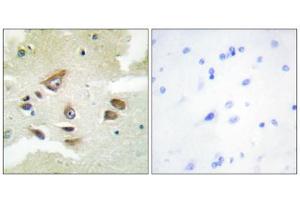 Immunohistochemistry analysis of paraffin-embedded human brain tissue using CLUS antibody. (Clusterin 抗体  (C-Term))