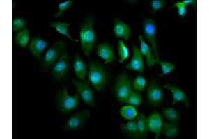 Immunofluorescence staining of A549 cells with ABIN7176088 at 1:266, counter-stained with DAPI. (ZMIZ1 抗体  (AA 405-559))