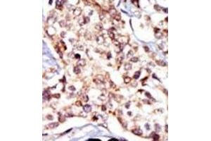 Immunohistochemistry (Paraffin-embedded Sections) (IHC (p)) image for anti-Proto-oncogene tyrosine-protein kinase Src (Src) (AA 1-30), (N-Term) antibody (ABIN392107)