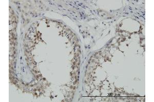 Immunoperoxidase of monoclonal antibody to HSPA1B on formalin-fixed paraffin-embedded human testis. (HSPA1B 抗体  (AA 531-611))