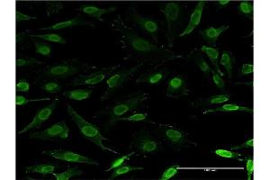 Immunofluorescence of monoclonal antibody to IKZF3 on HeLa cell. (IKZF3 抗体  (AA 1-509))