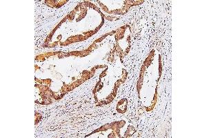 IHC analysis of TDRD3 using anti-TDRD3 antibody (ABIN6719636). (TDRD3 抗体)