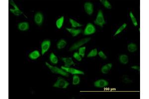Immunofluorescence of purified MaxPab antibody to TRIM25 on HeLa cell. (TRIM25 抗体  (AA 1-630))