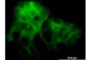 Image no. 2 for anti-Protocadherin 1 (PCDH1) (AA 62-170) antibody (ABIN598857) (Protocadherin 1 抗体  (AA 62-170))
