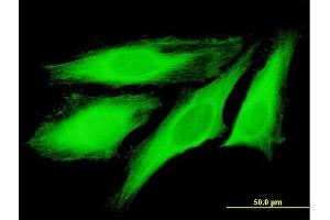 Immunofluorescence of purified MaxPab antibody to TUBB4Q on HeLa cell. (TUBB7P 抗体  (AA 1-434))