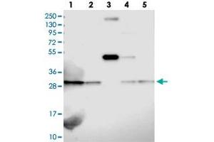 Western blot analysis of Lane 1: RT-4, Lane 2: U-251 MG, Lane 3: Human Plasma, Lane 4: Liver, Lane 5: Tonsil with C19orf52 polyclonal antibody  at 1:100-1:250 dilution.