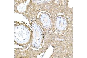 Immunohistochemistry (IHC) image for anti-Collagen, Type I, alpha 1 (COL1A1) (AA 100-200) antibody (ABIN6138837)