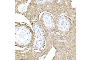 Immunohistochemistry of paraffin-embedded rat ovary using Collagen I/COL1 Rabbit pAb (352) at dilution of 1:150 (40x lens). (COL1A1 抗体  (AA 100-200))