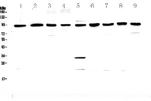 Western blot analysis of GNS using anti-GNS antibody . (GNS 抗体  (AA 238-355))