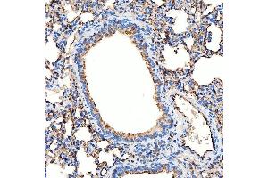 IHC analysis of SLC9A3R2 using anti-SLC9A3R2 antibody (ABIN7599271).