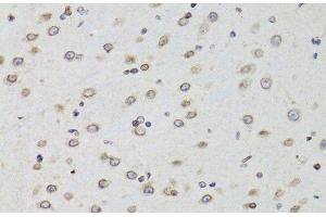 Immunohistochemistry of paraffin-embedded Mouse brain using TMPO Polyclonal Antibody at dilution of 1:100 (40x lens). (Thymopoietin 抗体)