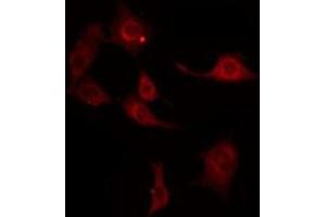 Immunofluorescence (fixed cells) (IF/ICC) image for anti-V-Erb-A erythroblastic Leukemia Viral Oncogene Homolog 4 (Avian) (ERBB4) (C-Term) antibody (ABIN6262216)