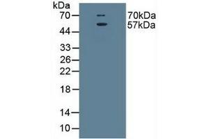 Detection of EAAT3 in Rat Brain Tissue using Polyclonal Antibody to Excitatory Amino Acid Transporter 3 (EAAT3) (SLC1A1 抗体  (AA 115-209))