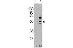 Western blot analysis of MEF2C antibody and 293 cell lysate (2 ug/lane) either nontransfected (Lane 1) or transiently transfected with the MEF2C gene (2). (MEF2C 抗体  (AA 37-66))