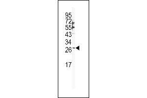 Western blot analysis of SNAI1 Antibody (N-term R8) (ABIN388810 and ABIN2839128) in NCI- cell line lysates (35 μg/lane). (SNAIL 抗体  (N-Term))