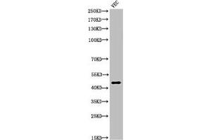 Western Blot analysis of VEC cells using Cleaved-Plasma Kallikrein HC (R390) Polyclonal Antibody (KLKB1 抗体  (Cleaved-Arg390))