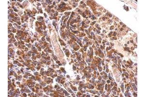 IHC-P Image MDH2 antibody detects MDH2 protein at cytosol on H1299 xenograft by immunohistochemical analysis. (MDH2 抗体)