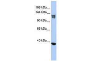 Image no. 1 for anti-SWI/SNF Related, Matrix Associated, Actin Dependent Regulator of Chromatin, Subfamily A, Member 1 (SMARCA1) (AA 35-84) antibody (ABIN6742480)