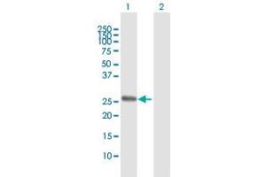 Western Blot analysis of TSSK3 expression in transfected 293T cell line by TSSK3 MaxPab polyclonal antibody. (TSSK3 抗体  (AA 1-268))