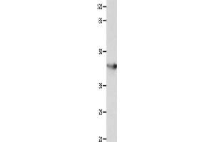 Western Blotting (WB) image for anti-Potassium Voltage-Gated Channel, Shaker-Related Subfamily, Member 5 (KCNA5) antibody (ABIN2428319) (KCNA5 抗体)