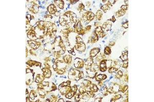 Immunohistochemistry of paraffin-embedded human stomach using S1/PR antibody (ABIN6129890, ABIN6136741, ABIN6136742 and ABIN6221835) at dilution of 1:200 (40x lens). (PRAS40 抗体  (AA 152-276))