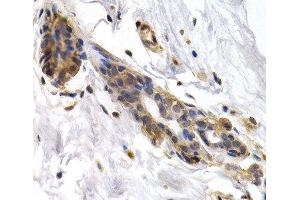 Immunohistochemistry of paraffin-embedded Human normal breast using PKLR Polyclonal Antibody at dilution of 1:200 (40x lens). (PKLR 抗体)