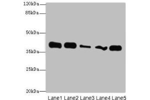 Western blot All lanes: KHDRBS2 antibody at 7 μg/mL Lane 1: K562 whole cell lysate Lane 2: Hela whole cell lysate Lane 3: A431 whole cell lysate Lane 4: Jurkat whole cell lysate Lane 5: NIH/3T3 whole cell lysate Secondary Goat polyclonal to rabbit IgG at 1/10000 dilution Predicted band size: 39 kDa Observed band size: 39 kDa (KHDRBS2 抗体  (AA 1-349))
