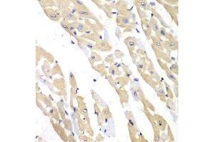 Immunohistochemistry of paraffin-embedded mouse heart using CCT3 antibody at dilution of 1:100 (x40 lens). (CCT3 抗体)