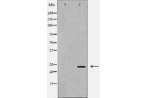 Western blot analysis of Hela whole cell lysates, using RAB11A  Antibody. (RAB11A 抗体  (C-Term))