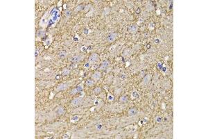 Immunohistochemistry of paraffin-embedded mouse brain using KCND3 antibody. (KCND3 抗体  (AA 502-636))