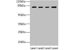 Western blot All lanes: DHX35 antibody at 12 μg/mL Lane 1: Mouse kidney tissue Lane 2: Mouse liver tissue Lane 3: K562 whole cell lysate Lane 4: Hela whole cell lysate Secondary Goat polyclonal to rabbit IgG at 1/10000 dilution Predicted band size: 79, 76 kDa Observed band size: 79 kDa