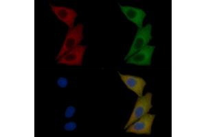 c-Kit Mouse Monoclonal Antibody staining Hela cells by IF/ICC. (KIT 抗体  (Internal Region))