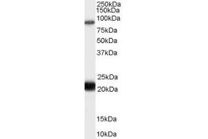 Western Blotting (WB) image for anti-RAS Protein Activator Like 1 (GAP1 Like) (RASAL1) (AA 794-806) antibody (ABIN292170) (RASAL1 抗体  (AA 794-806))