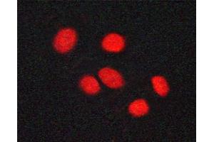 ABIN6267371 staining A549 cells by ICC/IF. (Vitamin D Receptor 抗体  (pSer208))
