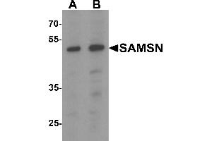 Western Blotting (WB) image for anti-SAM Domain, SH3 Domain and Nuclear Localization Signals, 1 (SAMSN1) (C-Term) antibody (ABIN1077391) (SAMSN1 抗体  (C-Term))