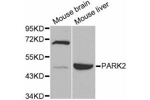 Western blot analysis of extracts of various cell lines, using PARK2 antibody (ABIN5998454) at 1/1000 dilution. (Parkin 抗体)