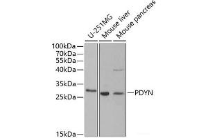 Western blot analysis of extracts of various cell lines using PDYN Polyclonal Antibody at dilution of 1:1000. (PDYN 抗体)