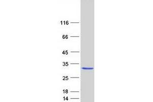 Western Blotting (WB) image for Grancalcin, EF-Hand Calcium Binding Protein (GCA) protein (Myc-DYKDDDDK Tag) (ABIN2722208)