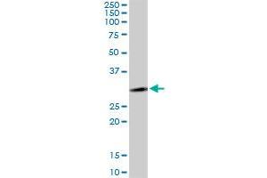 LYSMD2 MaxPab polyclonal antibody. (LYSMD2 抗体  (AA 1-215))