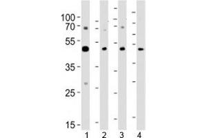 Western blot analysis of lysate from 1) A431, 2) K562, 3) CEM cell line and 4) rat brain tissue using SUV39H2 antibody at 1:1000. (SUV39H2 抗体  (AA 360-390))