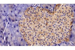 Immunohistochemistry (IHC) image for anti-Enolase 2 (Gamma, Neuronal) (ENO2) (AA 2-434) antibody (ABIN7437980)