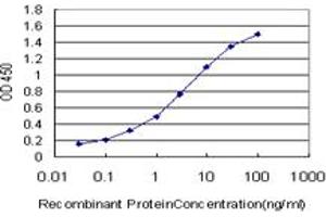 Detection limit for recombinant GST tagged PALM2 is approximately 0. (Paralemmin 2 抗体  (AA 321-411))