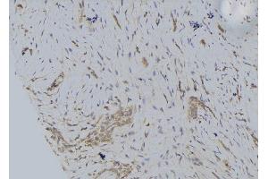ABIN6274652 at 1/100 staining Human lung tissue by IHC-P.