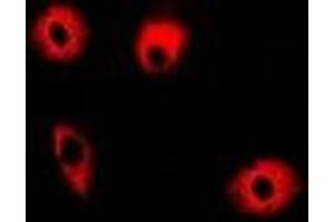 Immunofluorescent analysis of ABAT staining in A549 cells. (ABAT 抗体)