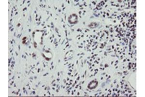 Image no. 1 for anti-Replication Factor C (Activator 1) 2, 40kDa (RFC2) (AA 1-234) antibody (ABIN1490616)