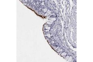 Immunohistochemical staining of human bronchus with C1orf114 polyclonal antibody  shows strong membranous positivity in respiratory epithelial cells. (C1orf114 抗体)
