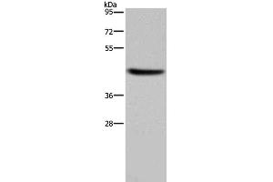 Western Blot analysis of Human adrenal gland tissue using HSD3B1 Polyclonal Antibody at dilution of 1:250 (HSD3B1 抗体)