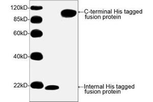 Image no. 2 for anti-His Tag (C-Term) antibody (ABIN294958) (His Tag 抗体  (C-Term))