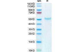 SDS-PAGE (SDS) image for Poliovirus Receptor-Related Immunoglobulin Domain Containing (PVRIG) (AA 41-171) protein (Fc Tag) (ABIN7275504)